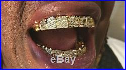 Custom fit 925 Sterling Silver Iced out Cubic CZ Micro Pave Block Grillz